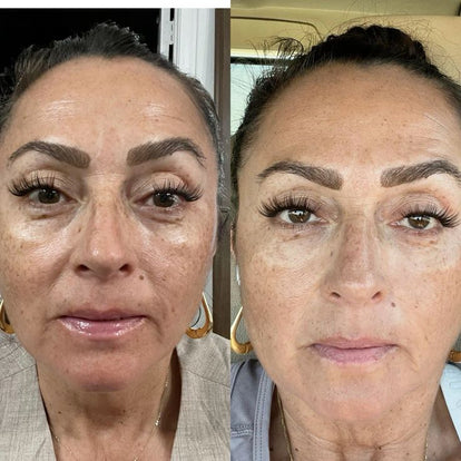 <p>« Les bouffées et les sueurs nocturnes me réveillaient plusieurs fois par nuit. Aujourd'hui c'est devenu rare, je dors enfin d'une traite. »</p><p><strong>Nathalie R., 53 ans</strong></p>