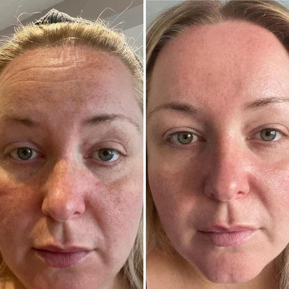 <p>« Mes collègues m'ont demandé si j'avais changé de crème. Non — juste un meilleur sommeil et une peau qui a retrouvé de l'éclat. »</p><p><strong>Isabelle D., 47 ans</strong></p>