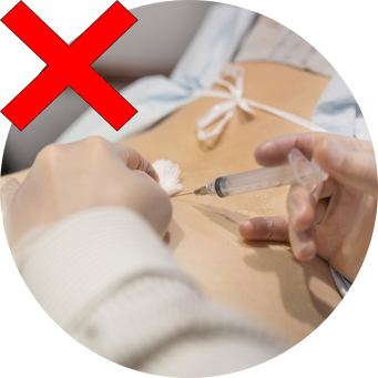 Injections de cortisone